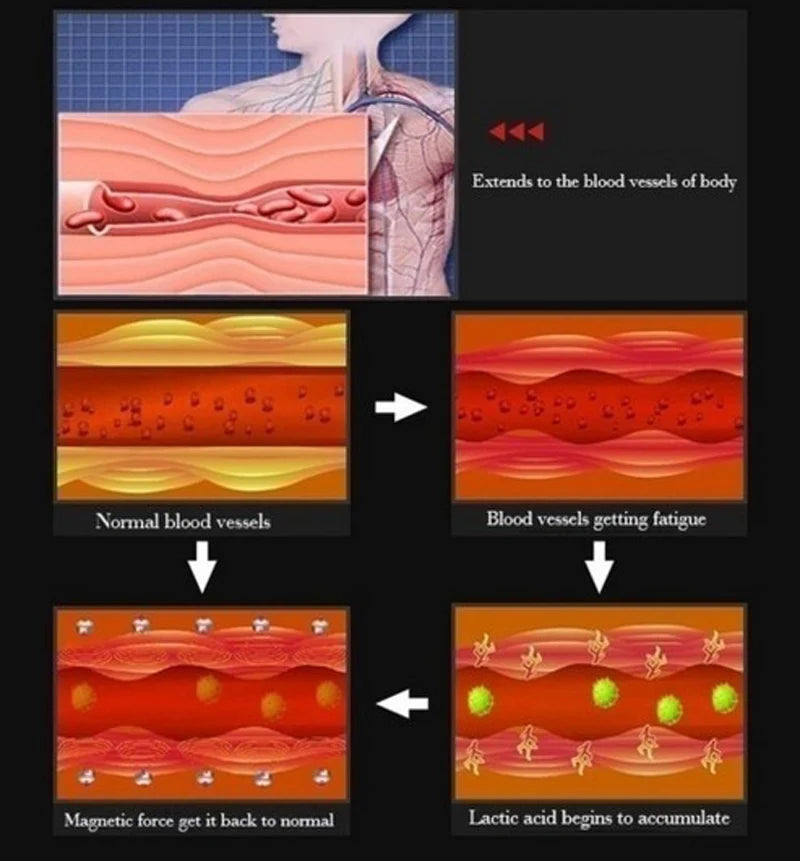 Tobilleras de terapia magnética para mujer, 99.9% de cobre sólido puro, imanes de Gauss, alivio del dolor en el tobillo para artritis, tamaño ajustable