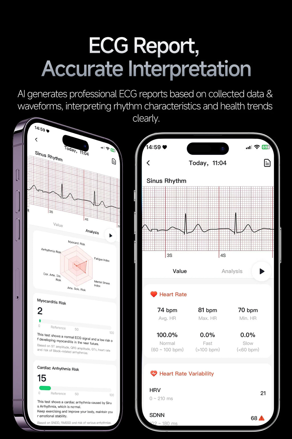 Nuevo Reloj Inteligente Médico con IA para Oxígeno en Sangre 2026, ECG Preciso, Ácido Úrico, Presión Arterial, Grasa Corporal, Fitness, Resistente al Agua