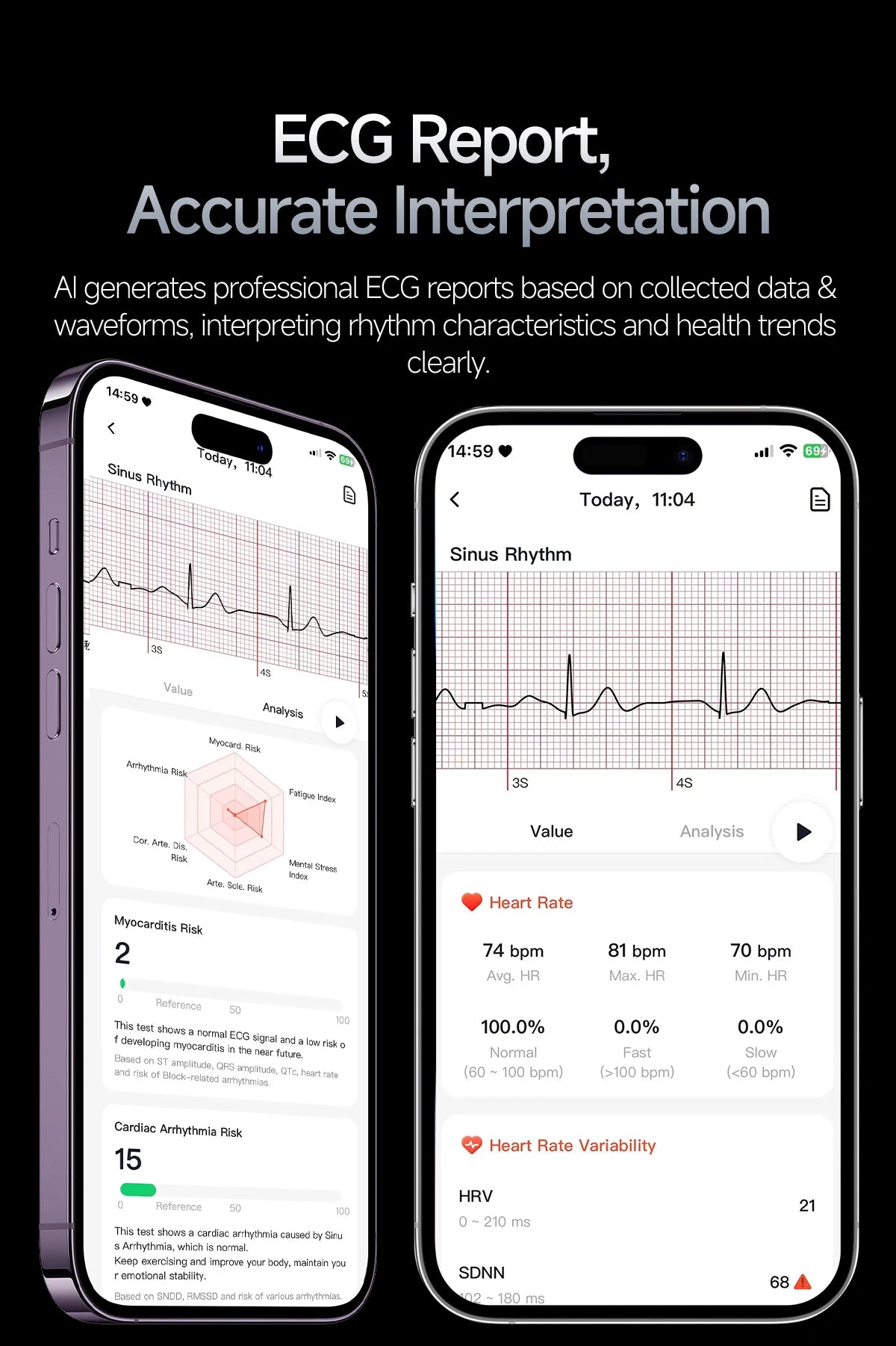 Nuevo Reloj Inteligente Médico con IA para Oxígeno en Sangre 2026, ECG Preciso, Ácido Úrico, Presión Arterial, Grasa Corporal, Fitness, Resistente al Agua